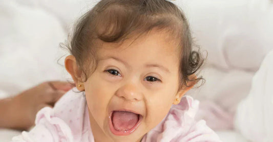 down syndrome baby